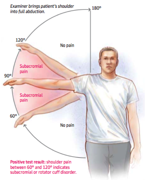 Weak Deltoid Muscle